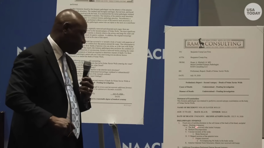 Poster boards showing Dr. Roger A. Mitchell Jr.'s preliminary second-autopsy report on Nolan Xavier Wells
