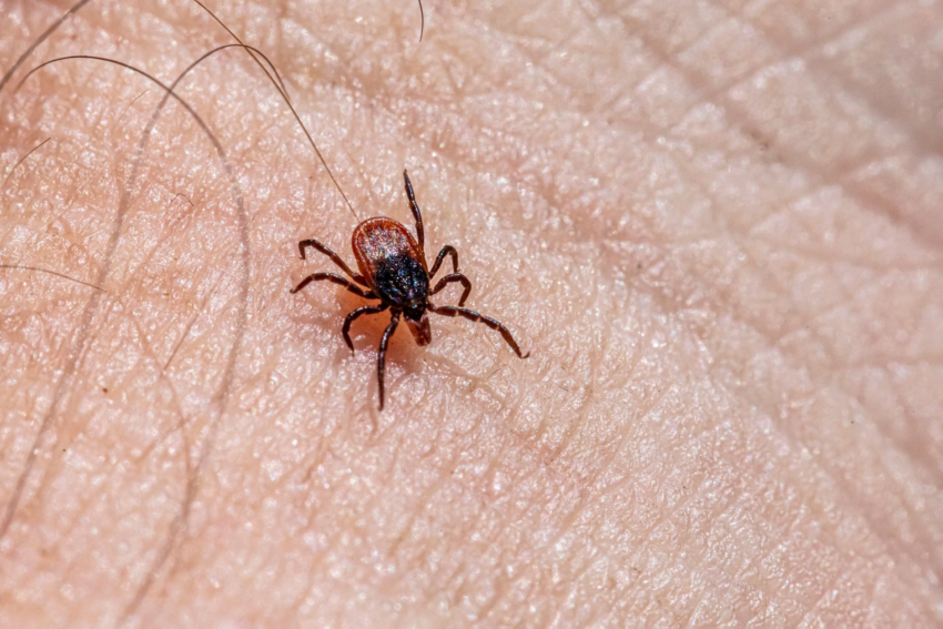 Explosive Diarrhea Parasite Cases Rise by Thousands, Now in 45 States