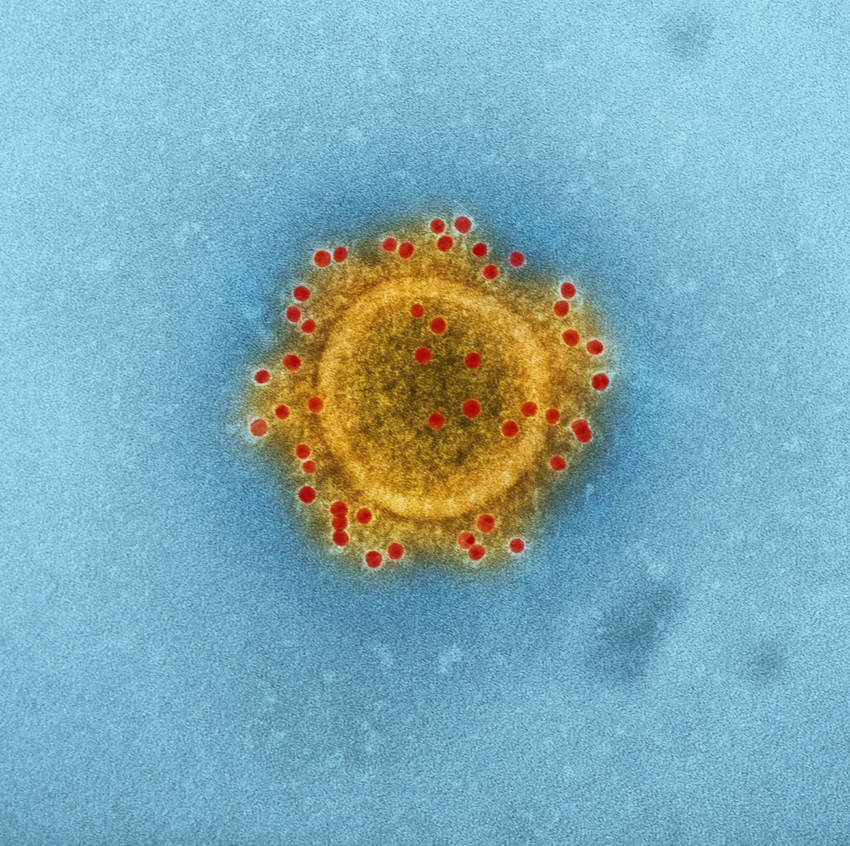 USDA Cyclospora Research Shuttered as Trump Admin Cuts Funds